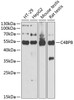 Western blot analysis of extracts of various cell lines, using C4BPB antibody (22-158) at 1:1000 dilution.<br/>Secondary antibody: HRP Goat Anti-Rabbit IgG (H+L) at 1:10000 dilution.<br/>Lysates/proteins: 25ug per lane.<br/>Blocking buffer: 3% nonfat dry milk in TBST.<br/>Detection: ECL Basic Kit.<br/>Exposure time: 30s.