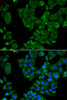 Immunofluorescence analysis of HeLa cells using DBN1 antibody (22-162) . Blue: DAPI for nuclear staining.