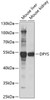 Western blot analysis of extracts of various cell lines, using DPYS antibody (22-164) at 1:1000 dilution.<br/>Secondary antibody: HRP Goat Anti-Rabbit IgG (H+L) at 1:10000 dilution.<br/>Lysates/proteins: 25ug per lane.<br/>Blocking buffer: 3% nonfat dry milk in TBST.<br/>Detection: ECL Basic Kit.<br/>Exposure time: 1s.