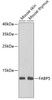Western blot analysis of extracts of various cell lines, using FABP5 antibody (22-169) at 1:1000 dilution.<br/>Secondary antibody: HRP Goat Anti-Rabbit IgG (H+L) at 1:10000 dilution.<br/>Lysates/proteins: 25ug per lane.<br/>Blocking buffer: 3% nonfat dry milk in TBST.<br/>Detection: ECL Basic Kit.<br/>Exposure time: 90s.