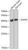 Western blot analysis of extracts of various cell lines, using GAP43 antibody (22-172) at 1:1000 dilution.<br/>Secondary antibody: HRP Goat Anti-Rabbit IgG (H+L) at 1:10000 dilution.<br/>Lysates/proteins: 25ug per lane.<br/>Blocking buffer: 3% nonfat dry milk in TBST.<br/>Detection: ECL Basic Kit.<br/>Exposure time: 90s.