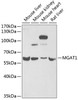 Western blot analysis of extracts of various cell lines, using MGAT1 antibody (22-178) at 1:1000 dilution.<br/>Secondary antibody: HRP Goat Anti-Rabbit IgG (H+L) at 1:10000 dilution.<br/>Lysates/proteins: 25ug per lane.<br/>Blocking buffer: 3% nonfat dry milk in TBST.<br/>Detection: ECL Basic Kit.<br/>Exposure time: 90s.