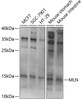 Western blot analysis of extracts of various cell lines, using MLN Antibody (22-179) at 1:1000 dilution.<br/>Secondary antibody: HRP Goat Anti-Rabbit IgG (H+L) at 1:10000 dilution.<br/>Lysates/proteins: 25ug per lane.<br/>Blocking buffer: 3% nonfat dry milk in TBST.<br/>Detection: ECL Basic Kit.<br/>Exposure time: 1s.