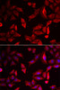 Immunofluorescence analysis of HeLa cells using SERPINB9 antibody (22-183) . Blue: DAPI for nuclear staining.