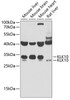 Western blot analysis of extracts of various cell lines, using KLK10 antibody (22-188) at 1:1000 dilution.<br/>Secondary antibody: HRP Goat Anti-Rabbit IgG (H+L) at 1:10000 dilution.<br/>Lysates/proteins: 25ug per lane.<br/>Blocking buffer: 3% nonfat dry milk in TBST.<br/>Detection: ECL Basic Kit.<br/>Exposure time: 90s.