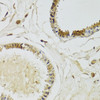 Immunohistochemistry of paraffin-embedded human breast using KLK10 Antibody (22-188) at dilution of 1:100 (40x lens) .