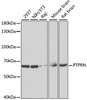 Western blot analysis of extracts of various cell lines, using PTPRN antibody (22-191) at 1:1000 dilution.<br/>Secondary antibody: HRP Goat Anti-Rabbit IgG (H+L) at 1:10000 dilution.<br/>Lysates/proteins: 25ug per lane.<br/>Blocking buffer: 3% nonfat dry milk in TBST.<br/>Detection: ECL Enhanced Kit.<br/>Exposure time: 90s.