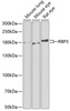 Western blot analysis of extracts of various cell lines, using RBP3 antibody (22-193) at 1:1000 dilution.<br/>Secondary antibody: HRP Goat Anti-Rabbit IgG (H+L) at 1:10000 dilution.<br/>Lysates/proteins: 25ug per lane.<br/>Blocking buffer: 3% nonfat dry milk in TBST.<br/>Detection: ECL Basic Kit.<br/>Exposure time: 90s.