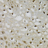 Immunohistochemistry of paraffin-embedded human esophagus using TRIM27 Antibody (22-195) at dilution of 1:100 (40x lens) .