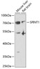 Western blot analysis of extracts of various cell lines, using SPINT1 antibody (22-201) at 1:1000 dilution._Secondary antibody: HRP Goat Anti-Rabbit IgG (H+L) at 1:10000 dilution._Lysates/proteins: 25ug per lane._Blocking buffer: 3% nonfat dry milk in TBST._Detection: ECL Enhanced Kit._Exposure time: 90s.