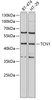 Western blot analysis of extracts of various cell lines, using TCN1 antibody (22-203) at 1:1000 dilution.<br/>Secondary antibody: HRP Goat Anti-Rabbit IgG (H+L) at 1:10000 dilution.<br/>Lysates/proteins: 25ug per lane.<br/>Blocking buffer: 3% nonfat dry milk in TBST.<br/>Detection: ECL Basic Kit.<br/>Exposure time: 10s.