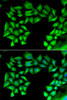 Immunofluorescence analysis of U2OS cells using TIMP4 antibody (22-204) . Blue: DAPI for nuclear staining.