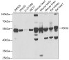 Western blot analysis of extracts of various cell lines, using PDHX antibody (22-212) at 1:1000 dilution.<br/>Secondary antibody: HRP Goat Anti-Rabbit IgG (H+L) at 1:10000 dilution.<br/>Lysates/proteins: 25ug per lane.<br/>Blocking buffer: 3% nonfat dry milk in TBST.<br/>Detection: ECL Basic Kit.<br/>Exposure time: 5s.