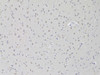 Immunohistochemistry of paraffin-embedded rat brain using AAAS Antibody (22-213) at dilution of 1:100 (20x lens) .