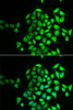 Immunofluorescence analysis of U2OS cells using NAPG antibody (22-218) . Blue: DAPI for nuclear staining.