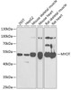 Western blot analysis of extracts of various cell lines, using MYOT antibody (22-222) at 1:1000 dilution._Secondary antibody: HRP Goat Anti-Rabbit IgG (H+L) at 1:10000 dilution._Lysates/proteins: 25ug per lane._Blocking buffer: 3% nonfat dry milk in TBST._Detection: ECL Enhanced Kit._Exposure time: 90s.