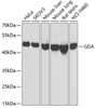 Western blot analysis of extracts of various cell lines, using GDA Antibody (22-224) at 1:1000 dilution.<br/>Secondary antibody: HRP Goat Anti-Rabbit IgG (H+L) at 1:10000 dilution.<br/>Lysates/proteins: 25ug per lane.<br/>Blocking buffer: 3% nonfat dry milk in TBST.<br/>Detection: ECL Basic Kit.<br/>Exposure time: 30s.