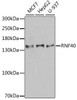 Western blot analysis of extracts of various cell lines, using RNF40 antibody (22-226) at 1:1000 dilution.<br/>Secondary antibody: HRP Goat Anti-Rabbit IgG (H+L) at 1:10000 dilution.<br/>Lysates/proteins: 25ug per lane.<br/>Blocking buffer: 3% nonfat dry milk in TBST.<br/>Detection: ECL Enhanced Kit.<br/>Exposure time: 90s.