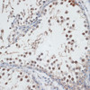 Immunohistochemistry of paraffin-embedded rat testis using AHSP antibody (22-245) at dilution of 1:100 (40x lens) .