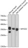 Western blot analysis of extracts of various cell lines, using MYOZ2 antibody (22-247) at 1:1000 dilution.<br/>Secondary antibody: HRP Goat Anti-Rabbit IgG (H+L) at 1:10000 dilution.<br/>Lysates/proteins: 25ug per lane.<br/>Blocking buffer: 3% nonfat dry milk in TBST.<br/>Detection: ECL Basic Kit.<br/>Exposure time: 10s.