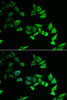 Immunofluorescence analysis of U2OS cells using MYOZ2 antibody (22-247) . Blue: DAPI for nuclear staining.