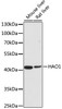 Western blot analysis of extracts of various cell lines, using HAO1 antibody (22-249) at 1:500 dilution.<br/>Secondary antibody: HRP Goat Anti-Rabbit IgG (H+L) at 1:10000 dilution.<br/>Lysates/proteins: 25ug per lane.<br/>Blocking buffer: 3% nonfat dry milk in TBST.<br/>Detection: ECL Basic Kit.<br/>Exposure time: 90s.
