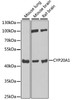 Western blot analysis of extracts of various cell lines, using CYP20A1 antibody (22-254) at 1:1000 dilution.<br/>Secondary antibody: HRP Goat Anti-Rabbit IgG (H+L) at 1:10000 dilution.<br/>Lysates/proteins: 25ug per lane.<br/>Blocking buffer: 3% nonfat dry milk in TBST.<br/>Detection: ECL Enhanced Kit.<br/>Exposure time: 90s.