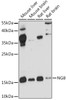 Western blot analysis of extracts of various cell lines, using NGB antibody (22-255) at 1:1000 dilution.<br/>Secondary antibody: HRP Goat Anti-Rabbit IgG (H+L) at 1:10000 dilution.<br/>Lysates/proteins: 25ug per lane.<br/>Blocking buffer: 3% nonfat dry milk in TBST.<br/>Detection: ECL Basic Kit.<br/>Exposure time: 90s.
