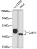 Western blot analysis of extracts of various cell lines, using CASP4 antibody (22-267) at 1:1000 dilution.<br/>Secondary antibody: HRP Goat Anti-Rabbit IgG (H+L) at 1:10000 dilution.<br/>Lysates/proteins: 25ug per lane.<br/>Blocking buffer: 3% nonfat dry milk in TBST.<br/>Detection: ECL Basic Kit.<br/>Exposure time: 60s.
