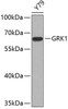 Western blot analysis of extracts of Y79 cells, using GRK1 antibody (22-268) .<br/>Secondary antibody: HRP Goat Anti-Rabbit IgG (H+L) at 1:10000 dilution.<br/>Lysates/proteins: 25ug per lane.<br/>Blocking buffer: 3% nonfat dry milk in TBST.