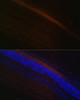 Immunofluorescence analysis of rat retina using GRK1 Polyclonal Antibody (22-268) at dilution of 1:100 (40x lens) . Blue: DAPI for nuclear staining.