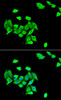 Immunofluorescence analysis of A549 cells using DNMT3A antibody (22-271) . Blue: DAPI for nuclear staining.