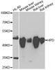 Western blot analysis of extracts of various cell lines, using HPD antibody (22-273) at 1:1000 dilution.<br/>Secondary antibody: HRP Goat Anti-Rabbit IgG (H+L) at 1:10000 dilution.<br/>Lysates/proteins: 25ug per lane.<br/>Blocking buffer: 3% nonfat dry milk in TBST.<br/>Detection: ECL Enhanced Kit.<br/>Exposure time: 10s.