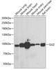 Western blot analysis of extracts of various cell lines, using GLI2 antibody (22-276) at 1:1000 dilution.<br/>Secondary antibody: HRP Goat Anti-Rabbit IgG (H+L) at 1:10000 dilution.<br/>Lysates/proteins: 25ug per lane.<br/>Blocking buffer: 3% nonfat dry milk in TBST.<br/>Detection: ECL Basic Kit.<br/>Exposure time: 90s.