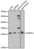 Western blot analysis of extracts of various cell lines, using AGPAT1 antibody (22-279) at 1:1000 dilution.<br/>Secondary antibody: HRP Goat Anti-Rabbit IgG (H+L) at 1:10000 dilution.<br/>Lysates/proteins: 25ug per lane.<br/>Blocking buffer: 3% nonfat dry milk in TBST.<br/>Detection: ECL Basic Kit.<br/>Exposure time: 90s.