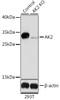 Western blot analysis of extracts from normal (control) and AK2 knockout (KO) 293T cells, using AK2 antibody (22-281) at 1:1000 dilution.<br/>Secondary antibody: HRP Goat Anti-Rabbit IgG (H+L) at 1:10000 dilution.<br/>Lysates/proteins: 25ug per lane.<br/>Blocking buffer: 3% nonfat dry milk in TBST.<br/>Detection: ECL Basic Kit.<br/>Exposure time: 90s.