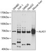 Western blot analysis of extracts of various cell lines, using ALAS1 antibody (22-283) at 1:1000 dilution.<br/>Secondary antibody: HRP Goat Anti-Rabbit IgG (H+L) at 1:10000 dilution.<br/>Lysates/proteins: 25ug per lane.<br/>Blocking buffer: 3% nonfat dry milk in TBST.<br/>Detection: ECL Basic Kit.<br/>Exposure time: 20s.