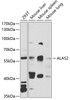 Western blot analysis of extracts of various cell lines, using ALAS2 antibody (22-284) at 1:1000 dilution.<br/>Secondary antibody: HRP Goat Anti-Rabbit IgG (H+L) at 1:10000 dilution.<br/>Lysates/proteins: 25ug per lane.<br/>Blocking buffer: 3% nonfat dry milk in TBST.<br/>Detection: ECL Basic Kit.<br/>Exposure time: 90s.