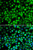 Immunofluorescence analysis of HeLa cells using ATP6AP2 antibody (22-290) . Blue: DAPI for nuclear staining.