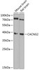 Western blot analysis of extracts of various cell lines, using CACNG2 Antibody (22-294) at 1:1000 dilution.<br/>Secondary antibody: HRP Goat Anti-Rabbit IgG (H+L) at 1:10000 dilution.<br/>Lysates/proteins: 25ug per lane.<br/>Blocking buffer: 3% nonfat dry milk in TBST.<br/>Detection: ECL Basic Kit.<br/>Exposure time: 10s.