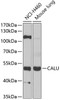 Western blot analysis of extracts of various cell lines, using CALU antibody (22-295) at 1:1000 dilution._Secondary antibody: HRP Goat Anti-Rabbit IgG (H+L) at 1:10000 dilution._Lysates/proteins: 25ug per lane._Blocking buffer: 3% nonfat dry milk in TBST._Detection: ECL Basic Kit._Exposure time: 90s.