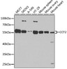 Western blot analysis of extracts of various cell lines, using CCT2 antibody (22-302) at 1:1000 dilution.<br/>Secondary antibody: HRP Goat Anti-Rabbit IgG (H+L) at 1:10000 dilution.<br/>Lysates/proteins: 25ug per lane.<br/>Blocking buffer: 3% nonfat dry milk in TBST.<br/>Detection: ECL Basic Kit.<br/>Exposure time: 15s.