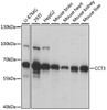 Western blot analysis of extracts of various cell lines, using CCT3 antibody (22-303) at 1:1000 dilution.<br/>Secondary antibody: HRP Goat Anti-Rabbit IgG (H+L) at 1:10000 dilution.<br/>Lysates/proteins: 25ug per lane.<br/>Blocking buffer: 3% nonfat dry milk in TBST.<br/>Detection: ECL Basic Kit.<br/>Exposure time: 5s.