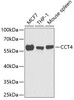 Western blot analysis of extracts of various cell lines, using CCT4 antibody (22-304) at 1:1000 dilution.<br/>Secondary antibody: HRP Goat Anti-Rabbit IgG (H+L) at 1:10000 dilution.<br/>Lysates/proteins: 25ug per lane.<br/>Blocking buffer: 3% nonfat dry milk in TBST.<br/>Detection: ECL Basic Kit.<br/>Exposure time: 90s.