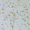 Immunohistochemistry of paraffin-embedded rat brain using CHIA Antibody (22-311) at dilution of 1:100 (40x lens) .