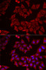 Immunofluorescence analysis of MCF7 cells using CMPK1 antibody (22-313) . Blue: DAPI for nuclear staining.