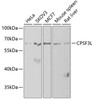 Western blot analysis of extracts of various cell lines, using CPSF3L antibody (22-317) at 1:1000 dilution.<br/>Secondary antibody: HRP Goat Anti-Rabbit IgG (H+L) at 1:10000 dilution.<br/>Lysates/proteins: 25ug per lane.<br/>Blocking buffer: 3% nonfat dry milk in TBST.<br/>Detection: ECL Basic Kit.<br/>Exposure time: 90s.