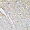 Immunohistochemistry of paraffin-embedded rat heart using CRHBP antibody (22-319) at dilution of 1:100 (40x lens) .