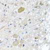 Immunohistochemistry of paraffin-embedded rat brain using CST1 antibody (22-321) at dilution of 1:100 (40x lens) .