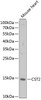 Western blot analysis of extracts of mouse heart, using CST2 antibody (22-322) at 1:1000 dilution.<br/>Secondary antibody: HRP Goat Anti-Rabbit IgG (H+L) at 1:10000 dilution.<br/>Lysates/proteins: 25ug per lane.<br/>Blocking buffer: 3% nonfat dry milk in TBST.<br/>Detection: ECL Enhanced Kit.<br/>Exposure time: 5min.